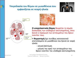 Υπερπλασία του θύμου σε μυασθένεια που
εμφανίζεται σε νεαρή ηλικία
Ο υπερπλαστικός θύμος θεωρείται το σημείο
δυσανεξίας των υποδοχέων ακετυλοχολίνης, όπου
ξεκινά η παραγωγή των αντισωμάτων που δρουν
εναντίον τους.
Η θυμεκτομή έχει συνήθως ικανοποιητικά
αποτελέσματα σε μυασθένεια που ξεκινά σε νεαρή
ηλικία:
- κλινική βελτίωση
- μείωση του ορού των αντισωμάτων που
δρουν εναντίον του υποδοχέα ακετυλοχολίνης
Βλαστικό
κέντρο
Αγγεία
16/10/2015 34
8ο Συνέδριο Πανελλήνιας Ένωσης
Σπανίων Παθήσεων - Ίδρυμα Ευγενίδου
 