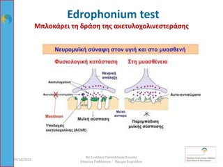 Μπλοκάρει τη δράση της ακετυλοχολινεστεράσης
16/10/2015 52
8ο Συνέδριο Πανελλήνιας Ένωσης
Σπανίων Παθήσεων - Ίδρυμα Ευγενίδου
Edrophonium test
 