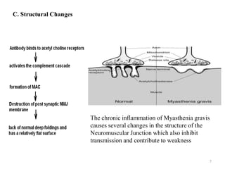 C. Structural Changes




                        The chronic inflammation of Myasthenia gravis
                        causes several changes in the structure of the
                        Neuromuscular Junction which also inhibit
                        transmission and contribute to weakness


                                                                     7
 