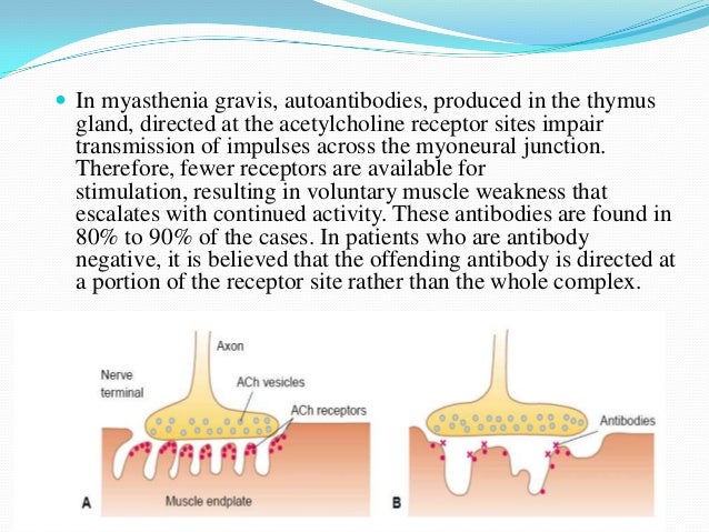 Acetylcholine Receptor Myasthenia Gravis Myasthenia Gravis | NEJM