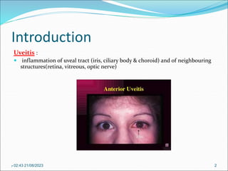 Introduction
Uveitis :
 inflammation of uveal tract (iris, ciliary body & choroid) and of neighbouring
structures(retina, vitreous, optic nerve)
21/08/2023
02:43
‫م‬ 2
 