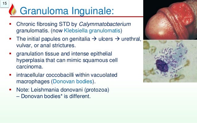 CALYMMATOBACTERIUM GRANULOMATIS PDF CALYMMATOBACTERIUM GRANULOMATIS PDF