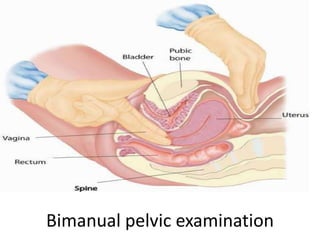 Bimanual pelvic examination
 