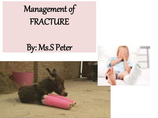 Management of
FRACTURE
By: Ms.S Peter
 