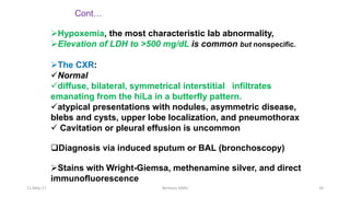 Hypoxemia, the most characteristic lab abnormality,
Elevation of LDH to >500 mg/dL is common but nonspecific.
The CXR:
Normal
diffuse, bilateral, symmetrical interstitial infiltrates
emanating from the hiLa in a butterfly pattern.
atypical presentations with nodules, asymmetric disease,
blebs and cysts, upper lobe localization, and pneumothorax
 Cavitation or pleural effusion is uncommon
Diagnosis via induced sputum or BAL (bronchoscopy)
Stains with Wright-Giemsa, methenamine silver, and direct
immunofluorescence
Cont…
11-May-17 Berhanu S(MI) 34
 