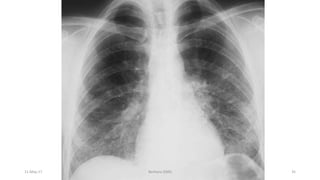 11-May-17 Berhanu S(MI) 35
 