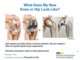What Does My New
Knee or Hip Look Like?
November 11, 2015
12
GUH surgeons use either DuPuy or Zimmer products. Ask your surgeon’s
office for specific details of your replacement.
GUH does not perform metal on metal replacements
 