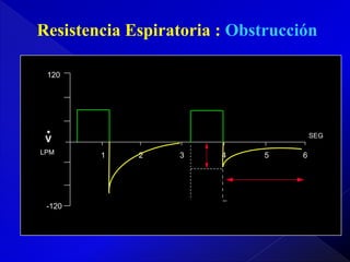 Resistencia Espiratoria : Obstrucción
120

.

SEG

V

LPM

-120

1

2

3

4

5

6

 