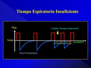 Flujo

Cambio Tiempo Espiratorio

Tiempo
AUTOPEEP

Flujo Fin-Espiratorio

 