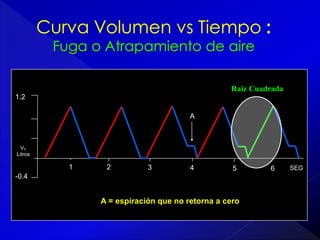 Raiz Cuadrada
1.2
A

VT
Litros

1

2

3

4

5

-0.4

A = espiración que no retorna a cero

6

SEG

 