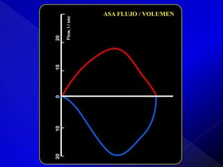 20

10

0

10

Flow, l / sec

20

ASA FLUJO / VOLUMEN

 