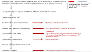 malignant hyperthermia anaesthesia point of view | PPTX