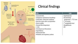 malignant hyperthermia anaesthesia point of view | PPTX