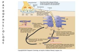 malignant hyperthermia anaesthesia point of view | PPTX