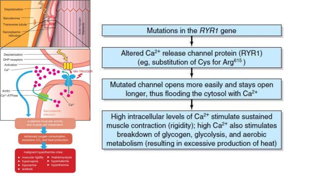 malignant hyperthermia anaesthesia point of view | PPTX | Genetics ...