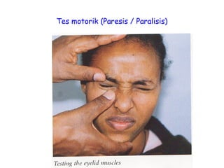 Tes motorik (Paresis / Paralisis)
 