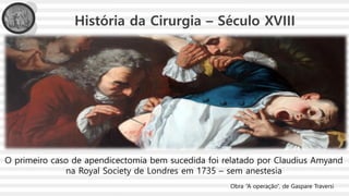 História da Cirurgia – Século XVIII
O primeiro caso de apendicectomia bem sucedida foi relatado por Claudius Amyand
na Royal Society de Londres em 1735 – sem anestesia
Obra “A operação”, de Gaspare Traversi
 