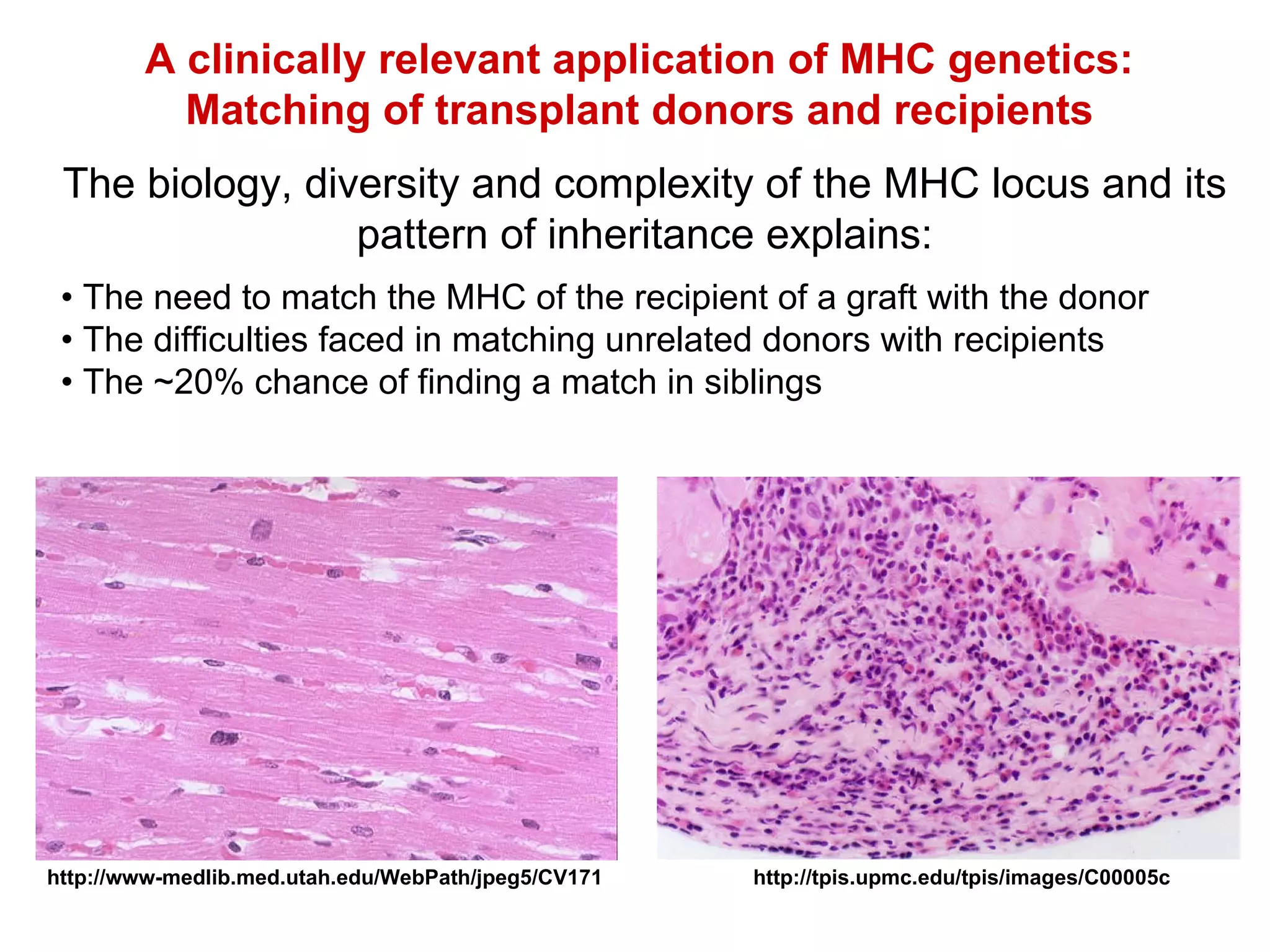 A clinically relevant application of MHC genetics: Matching of transplant donors and recipients The biology, diversity and complexity of the MHC locus and its pattern of inheritance explains: •  The need to match the MHC of the recipient of a graft with the donor •  The difficulties faced in matching unrelated donors with recipients •  The ~20% chance of finding a match in siblings http://tpis.upmc.edu/tpis/images/C00005c http://www-medlib.med.utah.edu/WebPath/jpeg5/CV171 