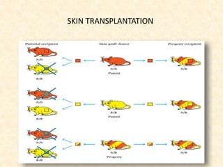 SKIN TRANSPLANTATION
 