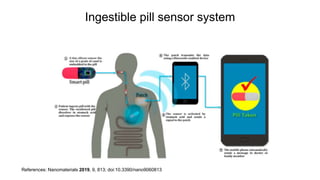 Ingestible pill sensor system
References: Nanomaterials 2019, 9, 813; doi:10.3390/nano9060813
 