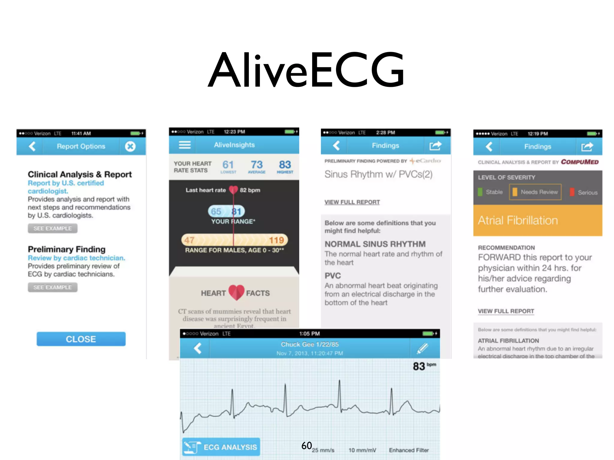 AliveECG 
60 
 