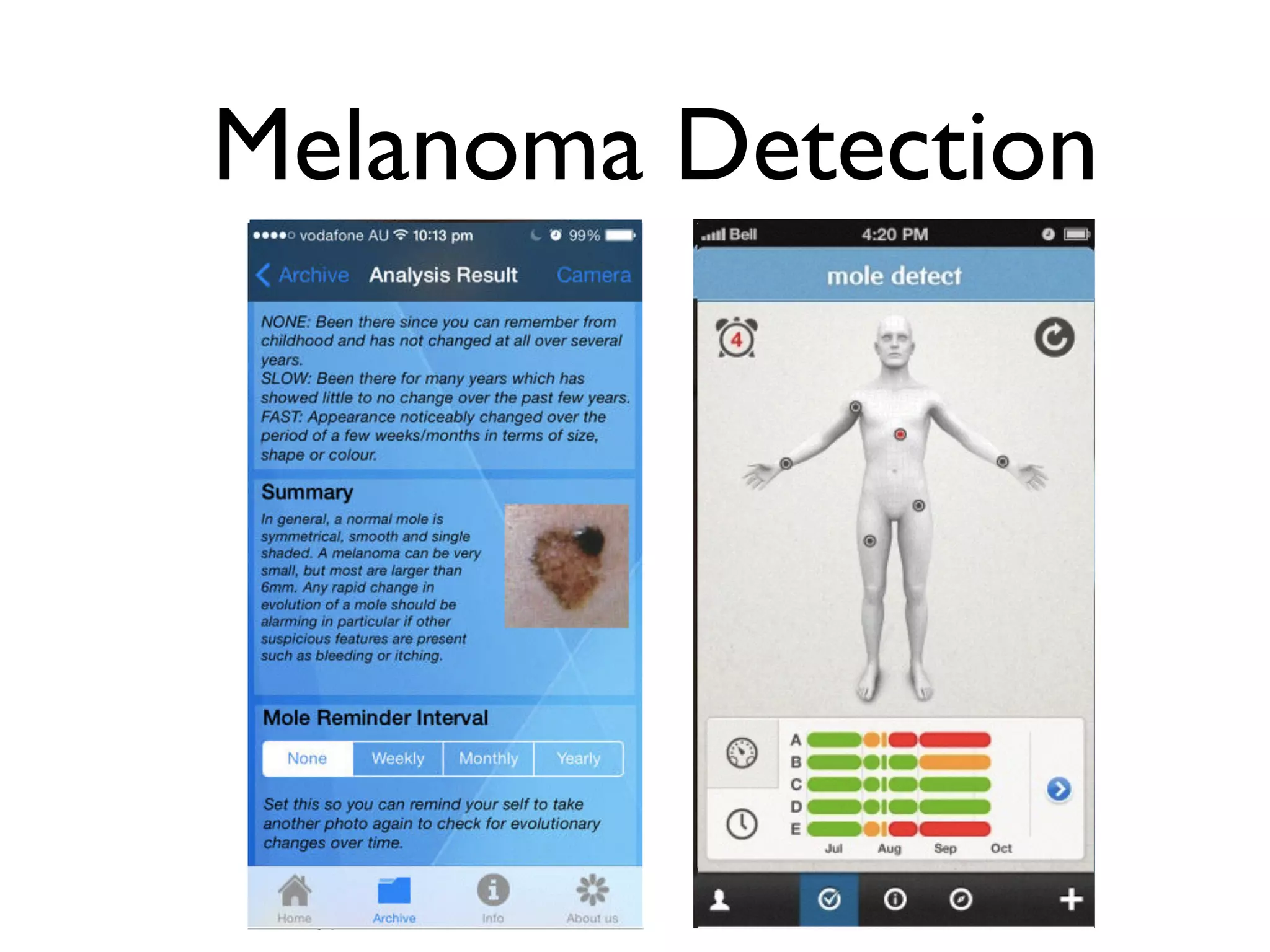 Melanoma Detection 
64 
 