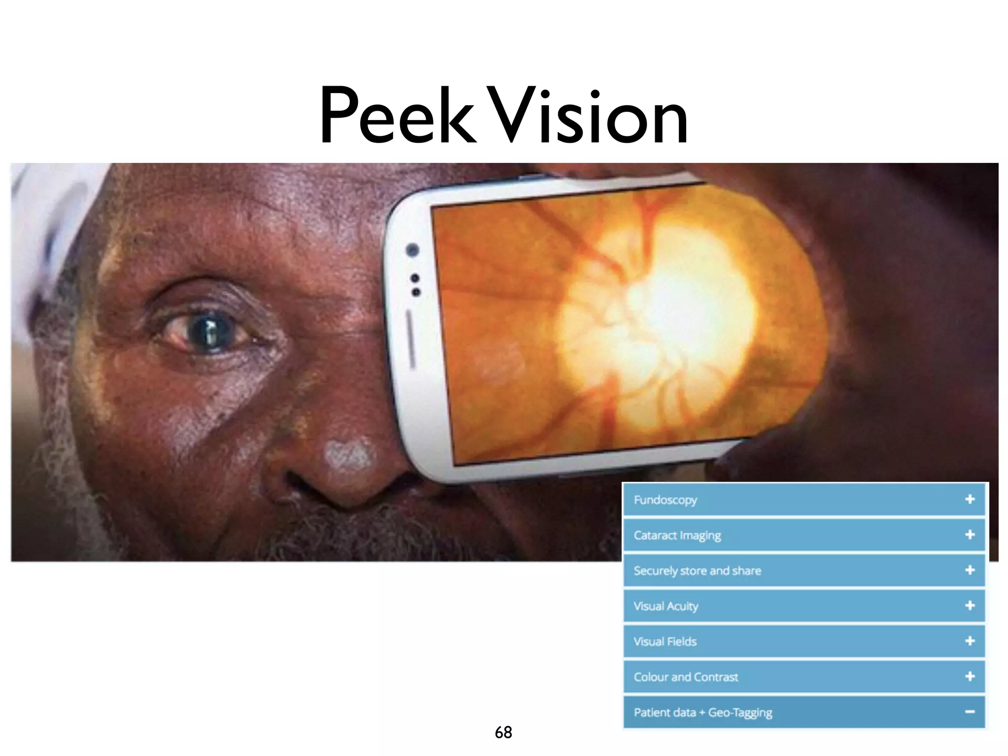 Peek Vision 
68 
 