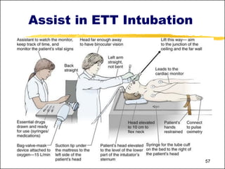 MHG1004-Lect 6-Assisting Dr in Definitive Airway Mx-intubation ...