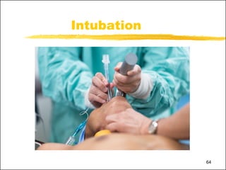 MHG1004-Lect 6-Assisting Dr in Definitive Airway Mx-intubation ...