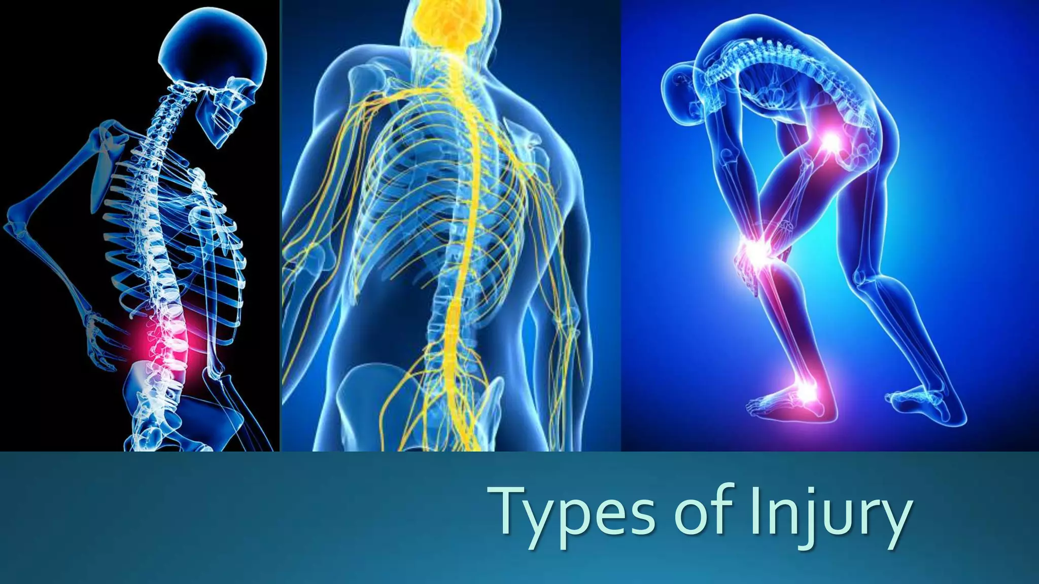 Types of Injury
 