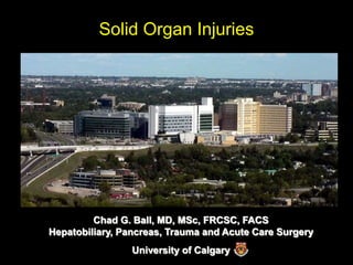 Solid Organ Injuries
Chad G. Ball, MD, MSc, FRCSC, FACS
Hepatobiliary, Pancreas, Trauma and Acute Care Surgery
University of Calgary
 