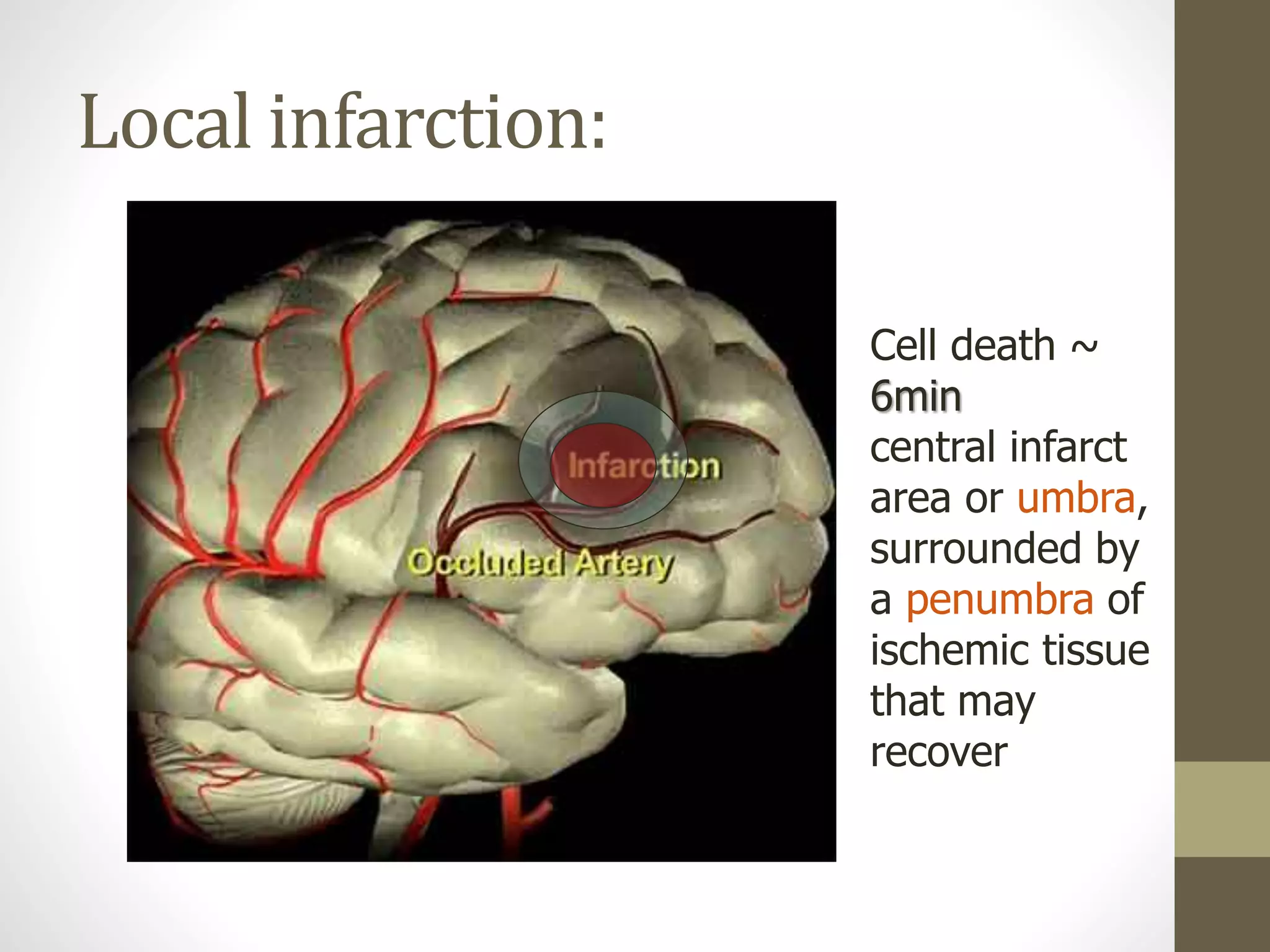 Local infarction:
Cell death ~
6min
central infarct
area or umbra,
surrounded by
a penumbra of
ischemic tissue
that may
recover
 