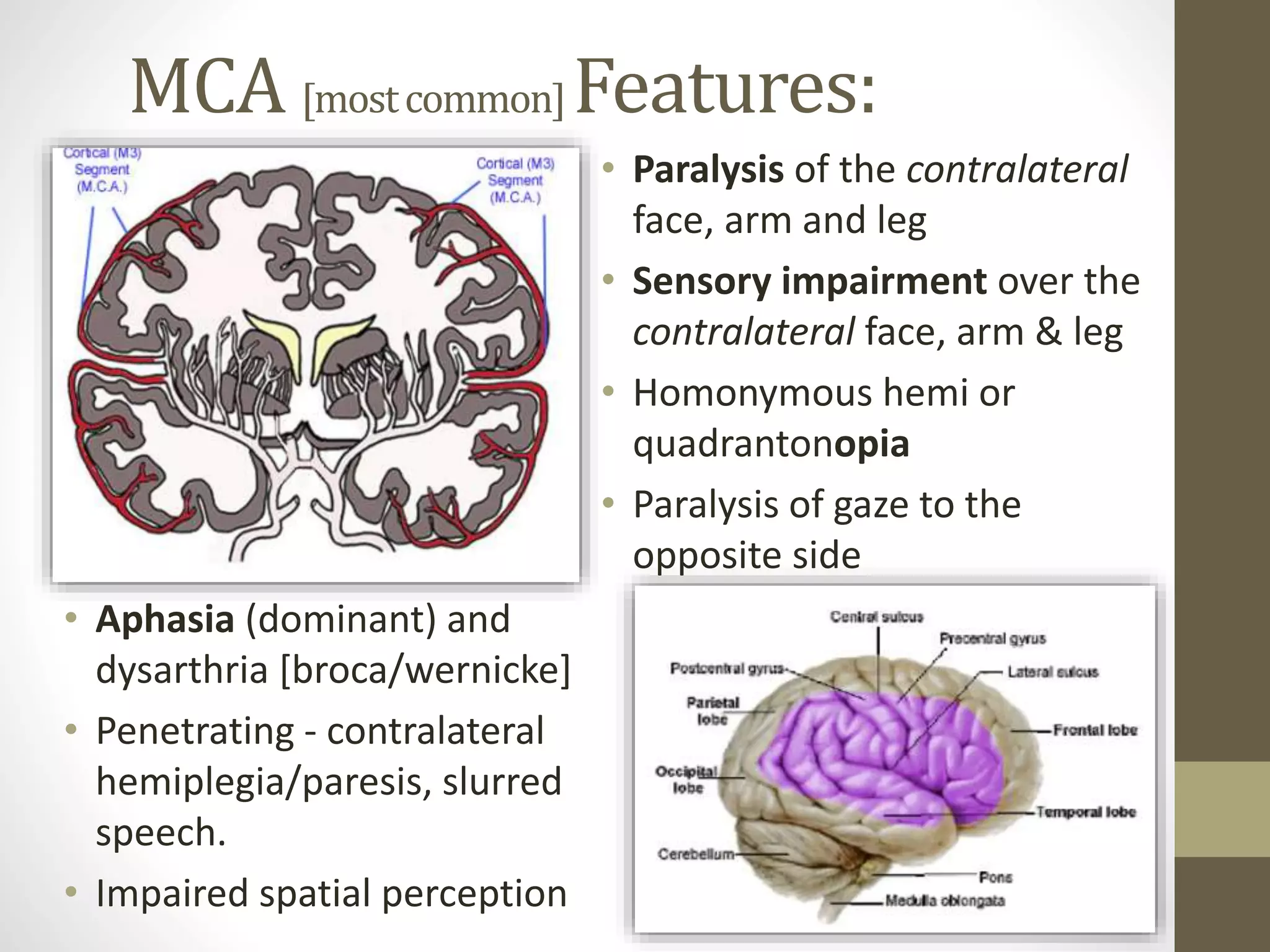 MCA [mostcommon]Features:
• Paralysis of the contralateral
face, arm and leg
• Sensory impairment over the
contralateral face, arm & leg
• Homonymous hemi or
quadrantonopia
• Paralysis of gaze to the
opposite side
• Aphasia (dominant) and
dysarthria [broca/wernicke]
• Penetrating - contralateral
hemiplegia/paresis, slurred
speech.
• Impaired spatial perception
 