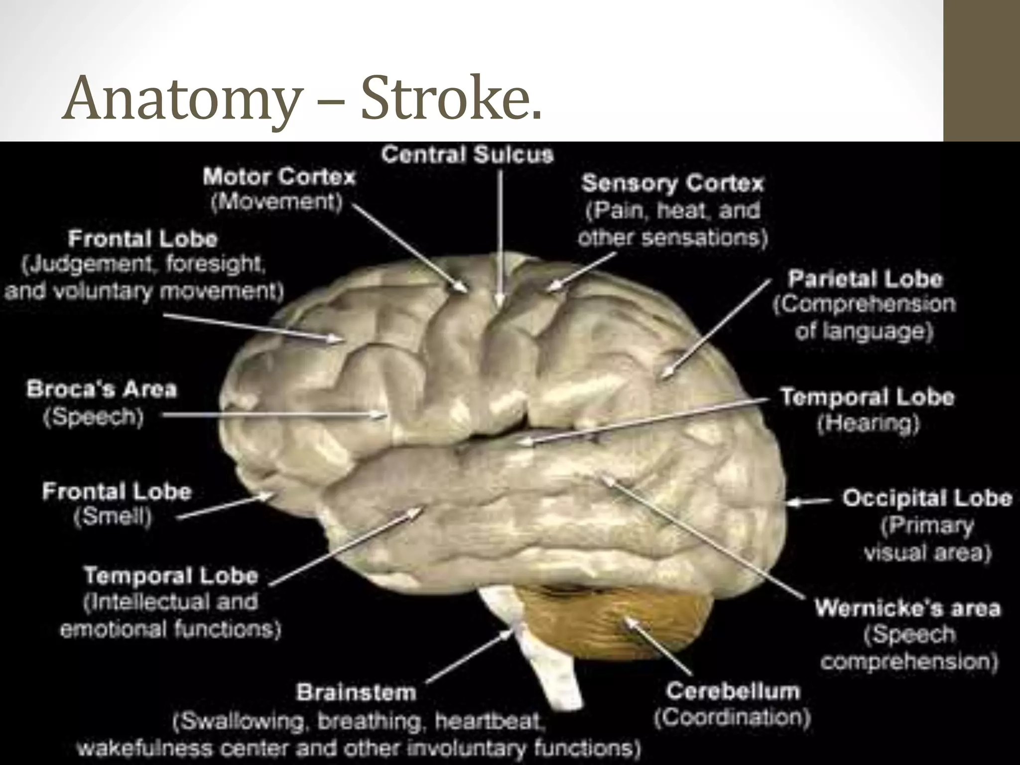 Anatomy – Stroke.
 