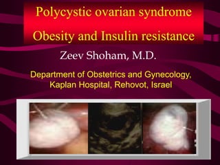 Polycystic ovarian syndrome
Obesity and Insulin resistance
Zeev Shoham, M.D.
Department of Obstetrics and Gynecology,
Kaplan Hospital, Rehovot, Israel
 