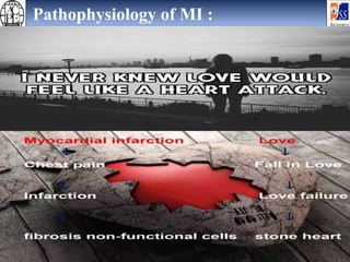 Pathophysiology of MI :
 