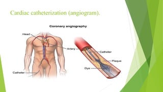 Cardiac catheterization (angiogram).
 