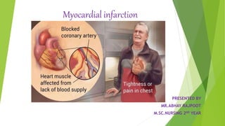Myocardial infarction
PRESENTED BY
MR.ABHAY RAJPOOT
M.SC.NURSING 2ND YEAR
 