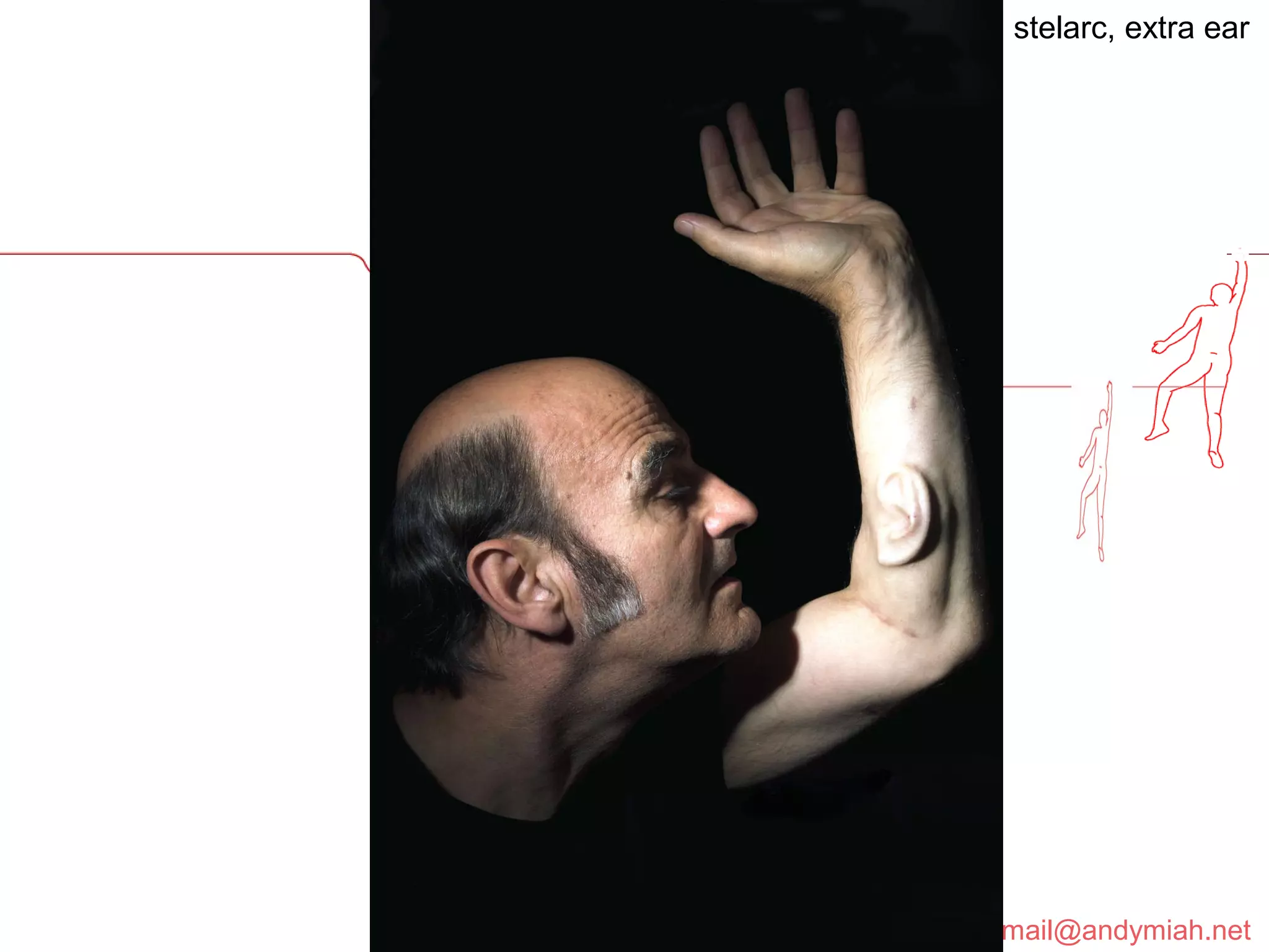 stelarc, extra ear 