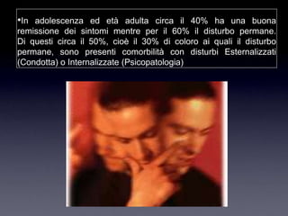 •In adolescenza ed età adulta circa il 40% ha una buona
remissione dei sintomi mentre per il 60% il disturbo permane.
Di questi circa il 50%, cioè il 30% di coloro ai quali il disturbo
permane, sono presenti comorbilità con disturbi Esternalizzati
(Condotta) o Internalizzate (Psicopatologia)
 
