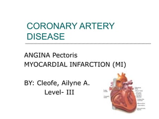CORONARY ARTERY
DISEASE
ANGINA Pectoris
MYOCARDIAL INFARCTION (MI)
BY: Cleofe, Ailyne A.
Level- III
 