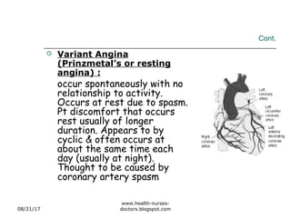 Cont.
 Variant Angina
(Prinzmetal’s or resting
angina) :
occur spontaneously with no
relationship to activity.
Occurs at rest due to spasm.
Pt discomfort that occurs
rest usually of longer
duration. Appears to by
cyclic & often occurs at
about the same time each
day (usually at night).
Thought to be caused by
coronary artery spasm
08/21/17
www.health-nurses-
doctors.blogspot.com
 