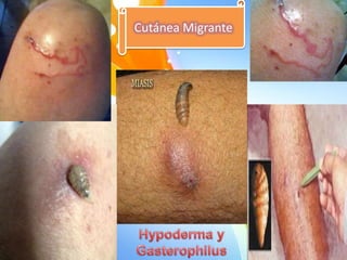 Cutánea Migrante

 