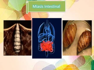 Miasis Intestinal

 