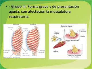 - Grupo III: Forma grave y de presentación aguda, con afectación la musculatura respiratoria. 