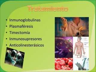 Inmunoglobulinas Plasmaféresis Timectomía Inmunosupresores Anticolinesterásicos 