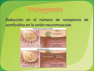 Reducción en el número de receptores de acetilcolina en la unión neuromuscular. 