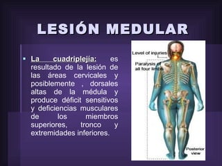 LESIÓN MEDULAR La cuadriplejía:   es resultado de la lesión de las áreas cervicales y posiblemente , dorsales altas de la médula y produce déficit sensitivos y deficiencias musculares de los miembros superiores, tronco y extremidades inferiores.  