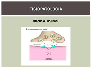 FISIOPATOLOGIA
Bloqueio Funcional
 