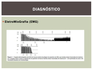  EletroMioGrafia (EMG)
DIAGNÓSTICO
 